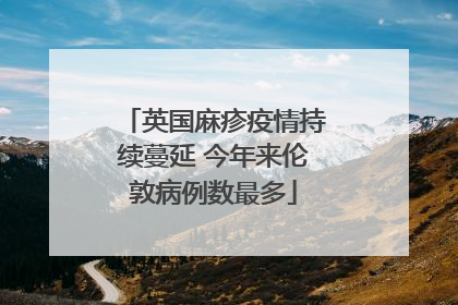 英国麻疹疫情持续蔓延 今年来伦敦病例数最多